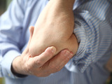 Artritida a artróza. Jaký je mezi nimi rozdíl? 